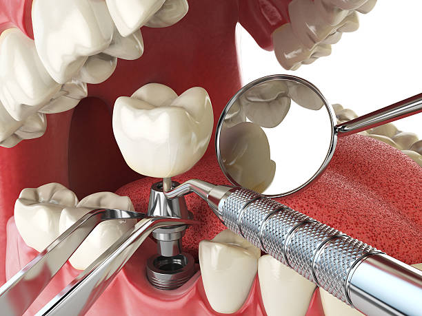 Best Emergency Dental Services for Seniors in Parker, TX